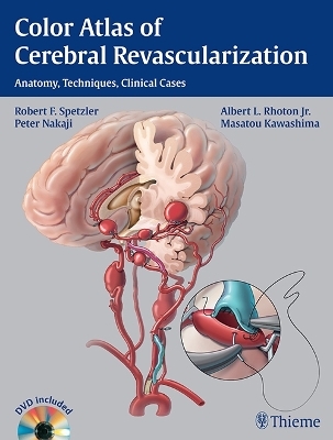 Color Atlas of Cerebral Revascularization - Robert F. Spetzler, Albert L. Rhoton, Peter Nakaji, Masatou Kawashima