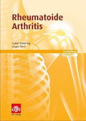 Rheumatoide Arthritis - Isabel Waltering, Jürgen Rech