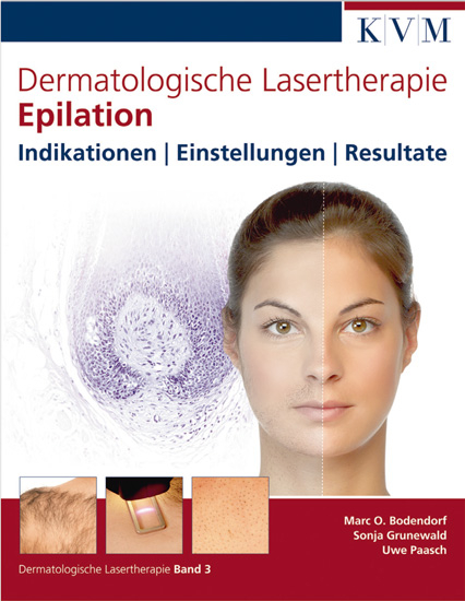 Dermatologische Lasertherapie Band 3: Epilation - Marc Oliver Bodendorf, Sonja Grunewald, Uwe Paasch
