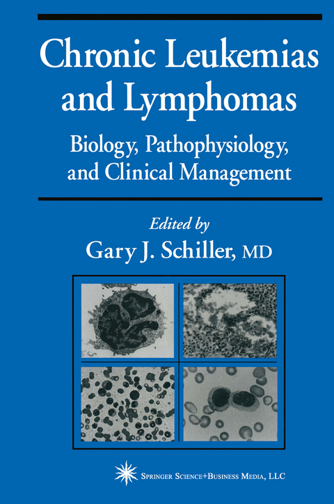 Chronic Leukemias and Lymphomas - 