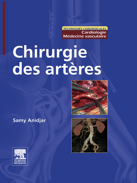 Chirurgie des artères -  Samy Anidjar