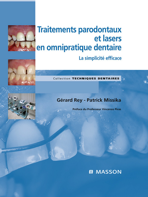 Traitements parodontaux et lasers en omnipratique dentaire -  Patrick Missika,  Gerard Rey