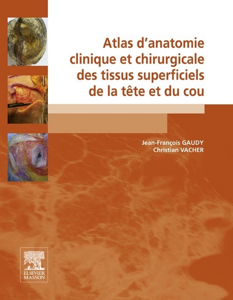 Atlas d''anatomie clinique et chirurgicale des tissus superficiels de la tête et du cou -  Jean-Francois Gaudy,  Christian Vacher