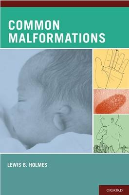 Common Malformations -  Lewis B. Holmes MD