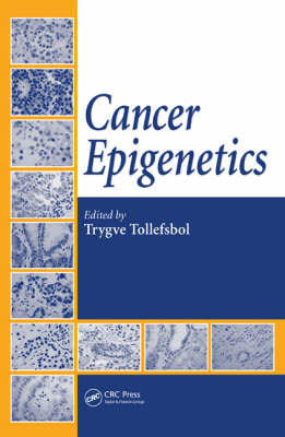 Cancer Epigenetics - 