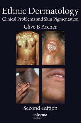 Ethnic Dermatology - 