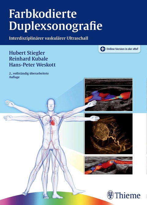 Farbkodierte Duplexsonografie - 