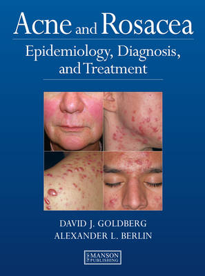 Acne and Rosacea -  Alexander Berlin,  David Goldberg