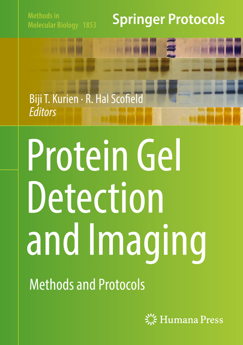 Protein Gel Detection and Imaging - 