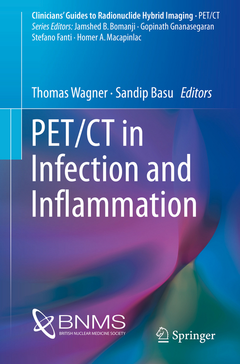 PET/CT in Infection and Inflammation - 