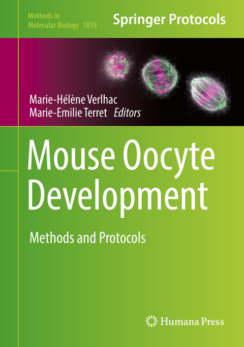 Mouse Oocyte Development - 