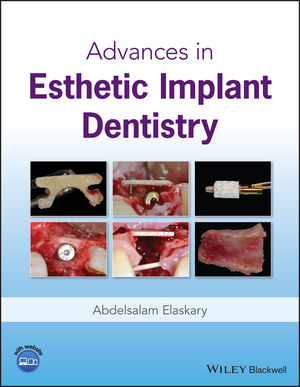 Advances in Esthetic Implant Dentistry - Abd El Salam El Askary