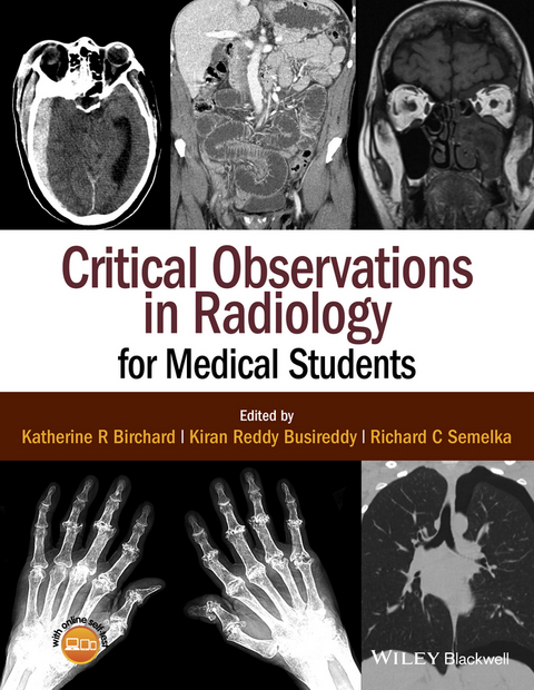 Critical Observations in Radiology for Medical Students - Katherine R. Birchard, Kiran Reddy Busireddy, Richard C. Semelka