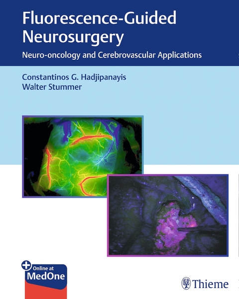 Fluorescence-Guided Neurosurgery - Costas Hadjipanayis, Walter Stummer