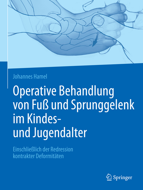 Operative Behandlung von Fuß und Sprunggelenk im Kindes- und Jugendalter - Johannes Hamel