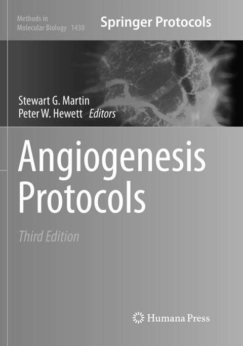 Angiogenesis Protocols - 