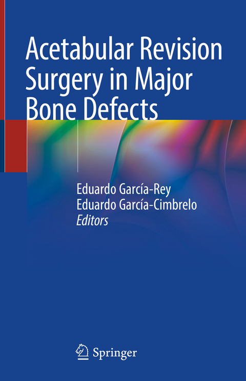 Acetabular Revision Surgery in Major Bone Defects - 
