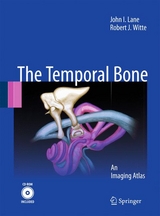 Temporal Bone - John I. Lane, Robert J. Witte
