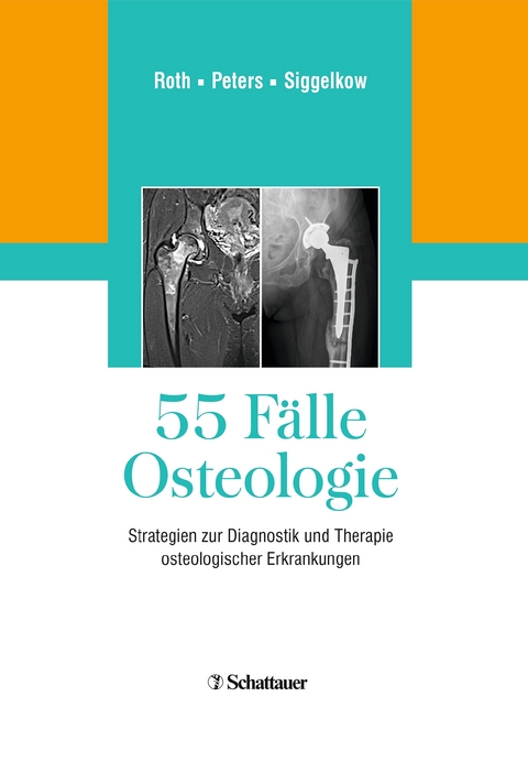55 Fälle Osteologie - 