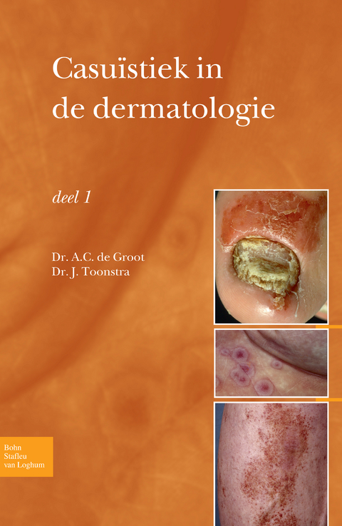 Casuïstiek in de dermatologie - deel I - Anton C. Groot, Johan Toonstra