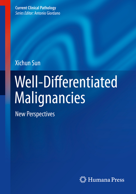 Well-Differentiated Malignancies - Xichun Sun