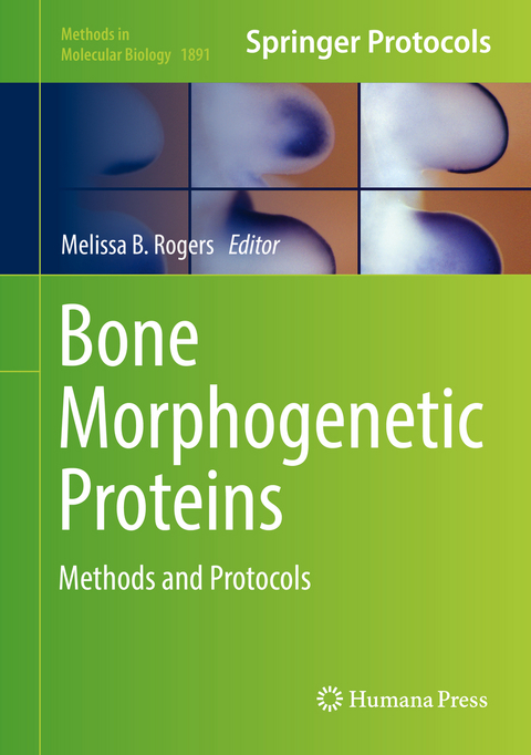 Bone Morphogenetic Proteins - 