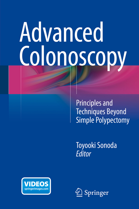 Advanced Colonoscopy - 