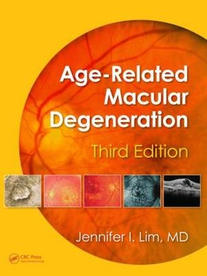 Age-Related Macular Degeneration, Third Edition - 