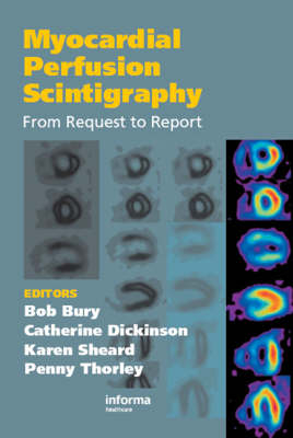 Myocardial Perfusion Scintigraphy -  Bob Bury,  Catherine Dickinson,  Karen Sheard,  Penny Thorley