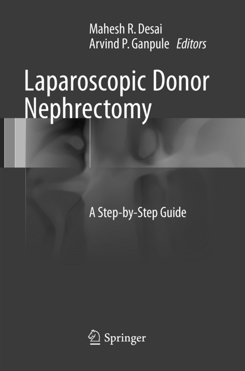 Laparoscopic Donor Nephrectomy - 