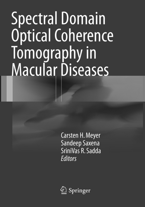 Spectral Domain Optical Coherence Tomography in Macular Diseases - 