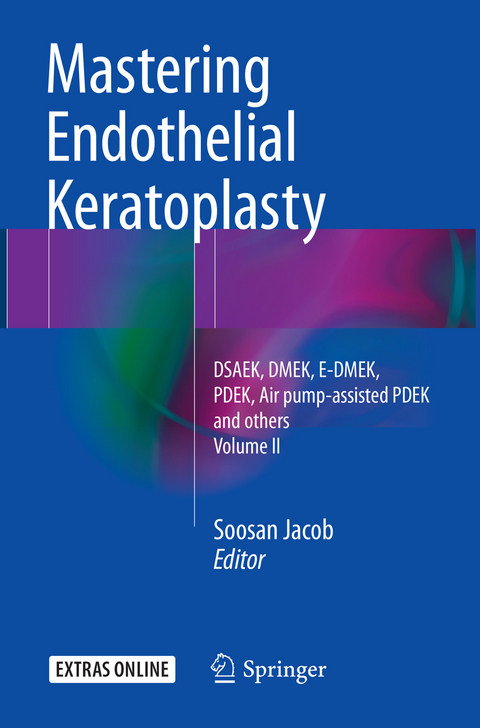 Mastering Endothelial Keratoplasty - 