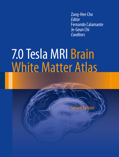 7.0 Tesla MRI Brain White Matter Atlas - 