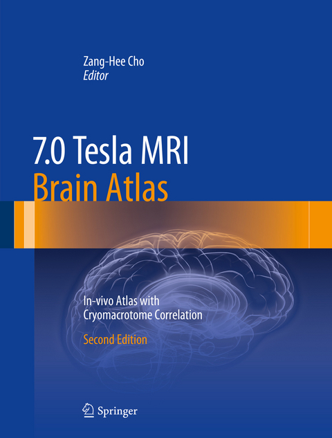 7.0 Tesla MRI Brain Atlas - 