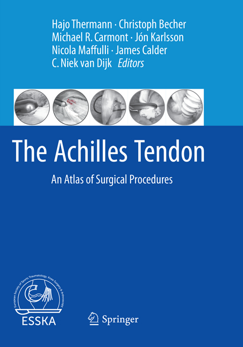 The Achilles Tendon - 