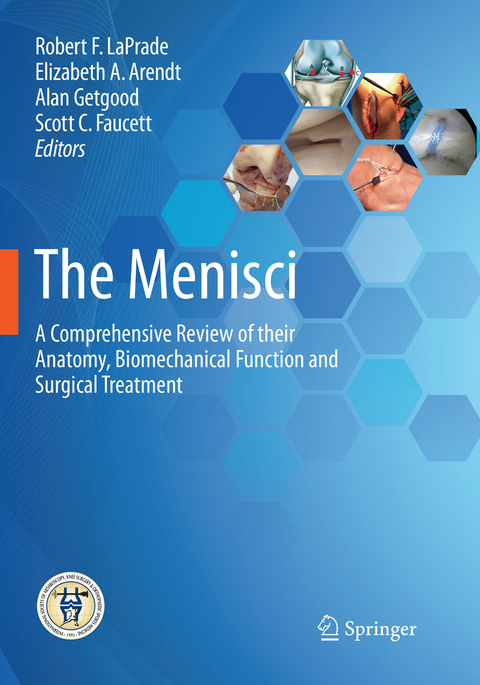 The Menisci - 