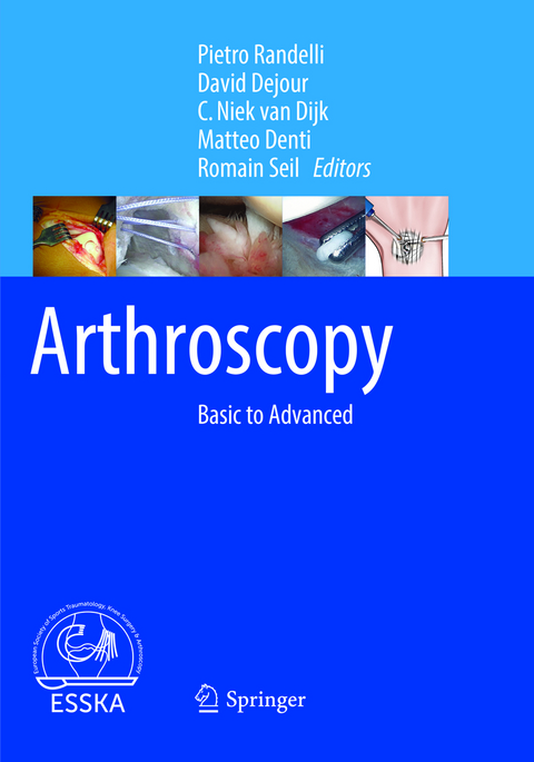Arthroscopy - 