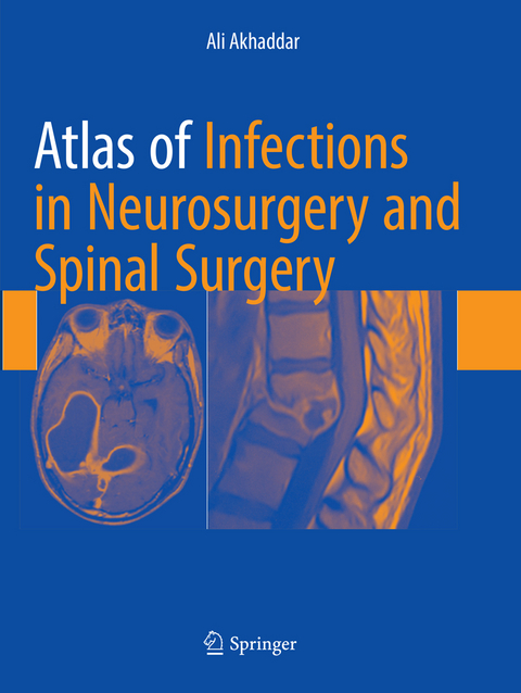 Atlas of Infections in Neurosurgery and Spinal Surgery - Ali Akhaddar