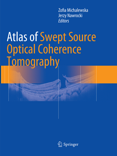 Atlas of Swept Source Optical Coherence Tomography - 