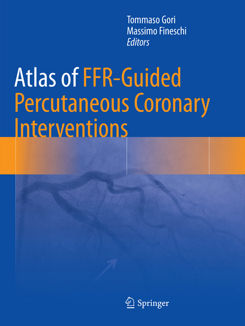 Atlas of FFR-Guided Percutaneous Coronary Interventions - 