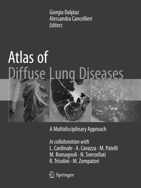 Atlas of Diffuse Lung Diseases - 