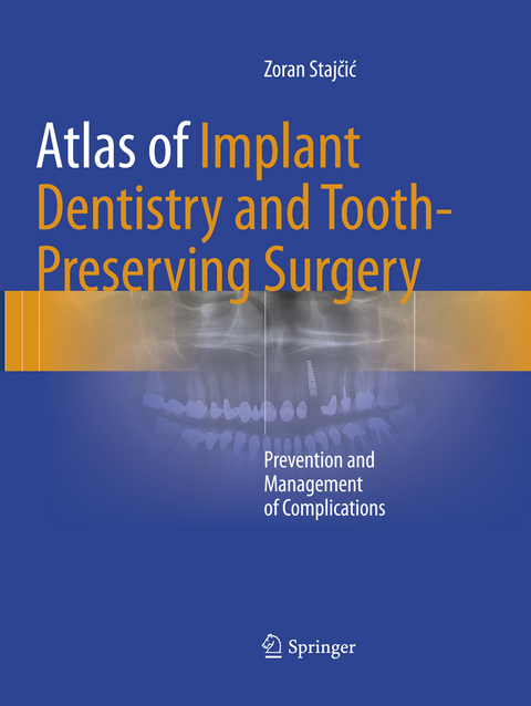 Atlas of Implant Dentistry and Tooth-Preserving Surgery - Zoran Stajčić