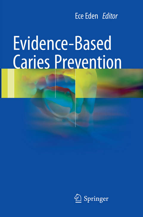 Evidence-Based Caries Prevention - 