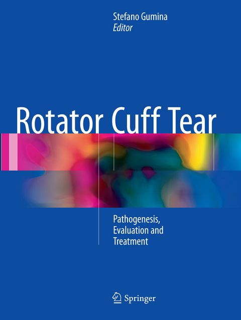 Rotator Cuff Tear - 