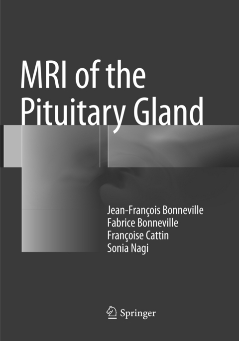 MRI of the Pituitary Gland - Jean-François Bonneville, Fabrice Bonneville, Françoise Cattin, Sonia Nagi