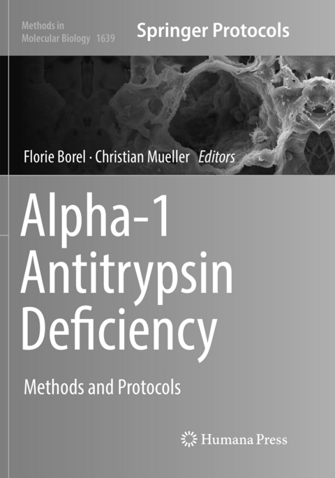 Alpha-1 Antitrypsin Deficiency - 