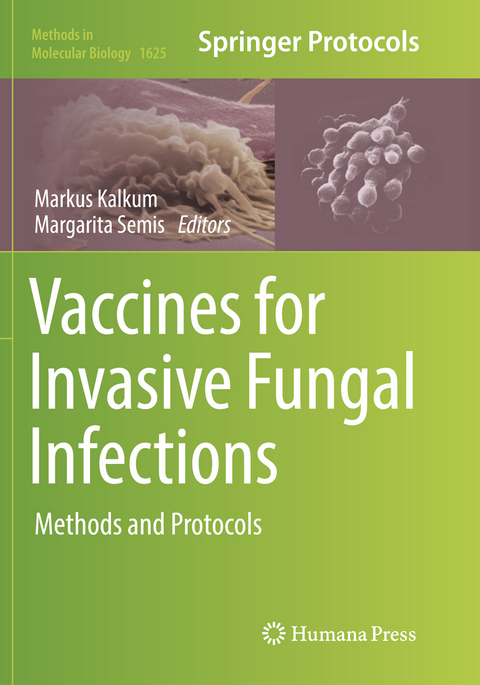 Vaccines for Invasive Fungal Infections - 