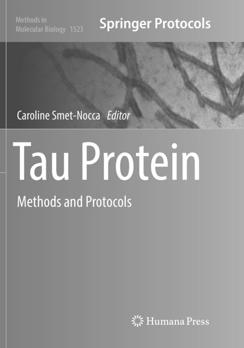 Tau Protein - 