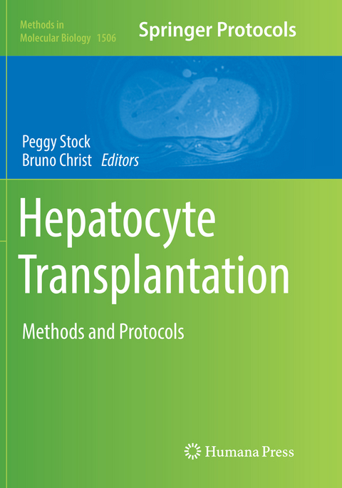 Hepatocyte Transplantation - 