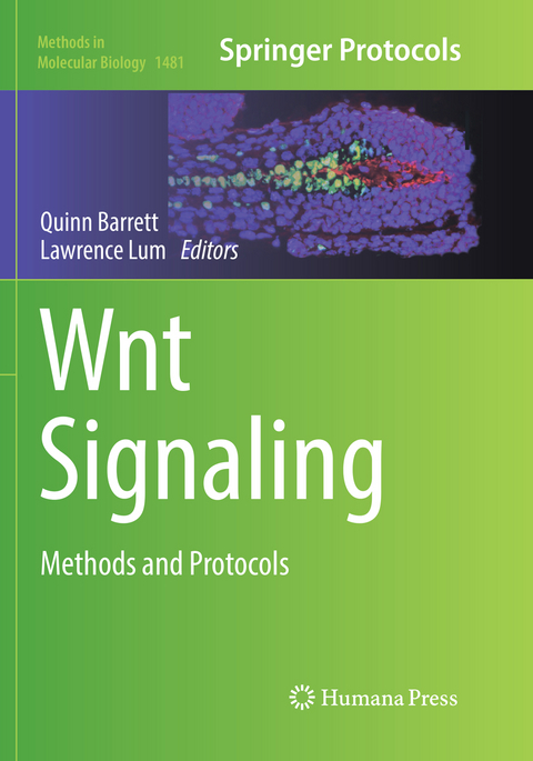 Wnt Signaling - 